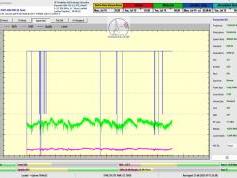 dxsatcs-rascom-qaf-1r-south-north-africa-79h-monitoring-TBS-monitoring-C01